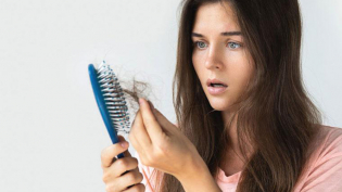 Chứng rụng tóc nguyên nhân do đâu?