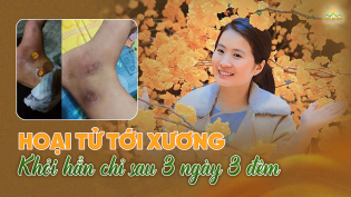 Vết hoại tử tới xương hồi phục hoàn toàn khi tu Pháp đàn Lương Hoàng Bảo Sám