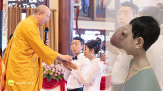 Cậu bé 'khối u mặt ngựa' ngày nào, nay đã có được hạnh phúc nhờ ánh sáng Phật Pháp