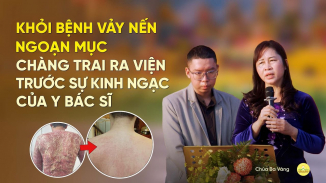 Chấm dứt 12 năm khổ sở vì vảy nến - chàng trai khỏi bệnh trước sự ngỡ ngàng của y bác sĩ