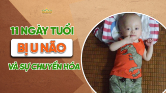 Cậu bé 11 ngày tuổi bị u não và sự chuyển hóa kỳ diệu