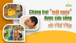 Chàng trai “mặt ngựa” được cứu sống nhờ tích cực điều trị và tu tập Phật Pháp