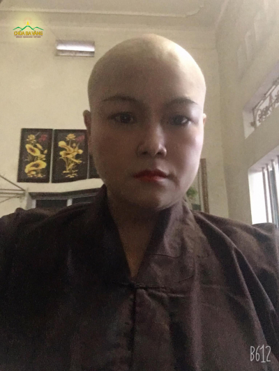 Chị Tuyết khi điều trị bệnh ung thư bằng hóa chất. 